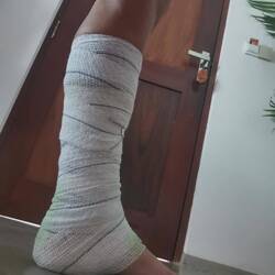 Mein Monsterverband