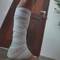 Mein Monsterverband