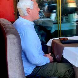 Haar Transplantionen sieht man öfters