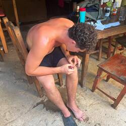 Piqûre d'oursins 🥵