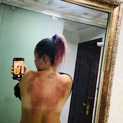 So sah mein Rücken aus 😂🤦🏾‍♀️