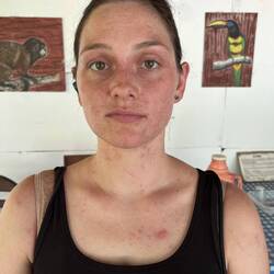 Tanjas Haut hat bei dem extremen Klima einiges mitmachen müssen