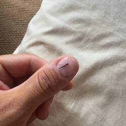 Hat sich Chris eingetreten