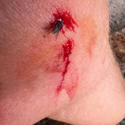 Autsch🩹 die Fliegen kommen sofort und sammeln sich in Scharen um die Wunde. Eklig!