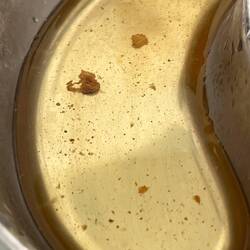 Die Befreiung, nach zweieinhalb Wochen schlecht hören, wurden mir die Ohren gereinigt.