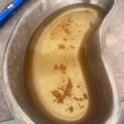 Konnte es gar nicht fassen, wie viel dreckig in meinem linken Ohr hatte.