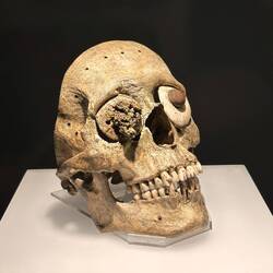 Die waren schon recht bewandert in Chirurgie