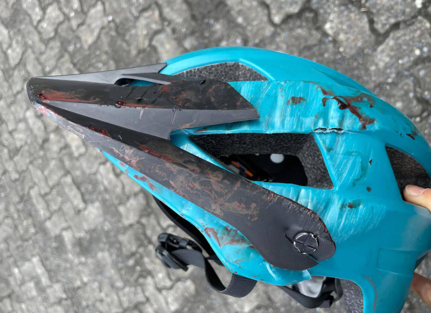 Pablo sent me this pic of my helmet. Saved me from worse injury for sure!