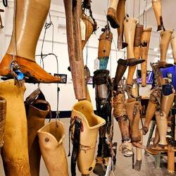 ... mit Prothesen und Reha.