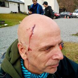 Twee dagen na de val en een wijze les rijker.