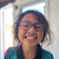 And a tooth fell out
