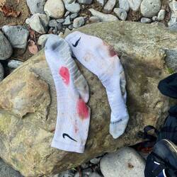 De Janis isch 4mal vo Bluetegel usgsuget worde 😆 hets aber nie gmerkt, het eifach afah blüete 😅