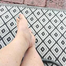 My bruised ankle caused by a torn? calf muscle