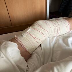 Poorly knee