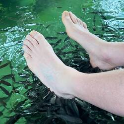 Le supplice des poissons amateurs de peaux mortes.