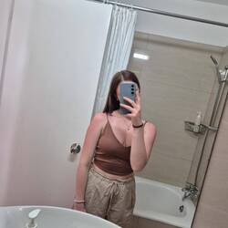 Sonnenbrand kassiert 😃