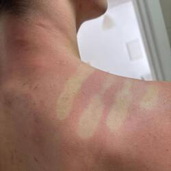 Sogar Vincent hats erwischt- das gab's noch nie!