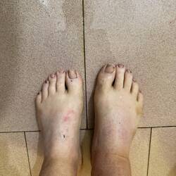 Meine gewaschenen(!) Füße! Beim Zoll musste ich durch Matsch in dem nichts gesundes steckte.