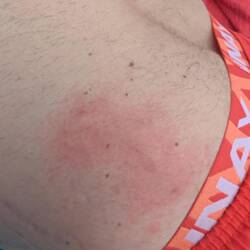 Voll in Specki gebissen