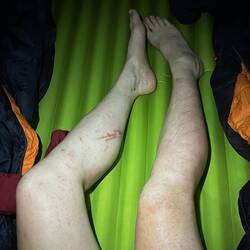 Unsere Beine haben gelitten. Genauso unsere Räder.