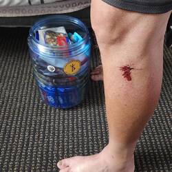 Scraped my leg a bit when hiking yesterday. 😬