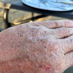 Salzgehalt des Wassers: 23 g/Liter, pH-Wert zehn