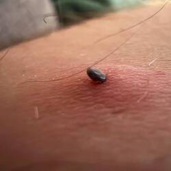 Nasty Tick