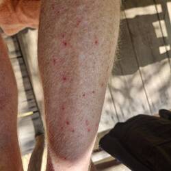 Fox has the pox 🤭