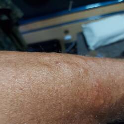 ... und Arm.
