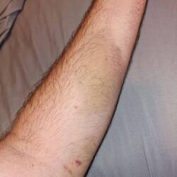 Ein paar ungewollte Souveniere.