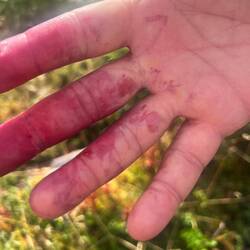 Nein ich wurde nicht vom Bären angegriffen 🙏