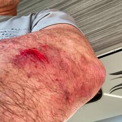 Auf dem Rückweg Susanne einen Schreck eingejagt😱Sturz mit dem Velo...Bild vom Knie lasse ich weg🫣