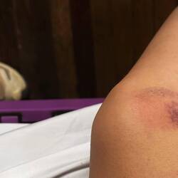 Die folgen des höchsten Skigebietes Südamerikas