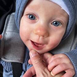 1 Zähnchen bricht bald durch