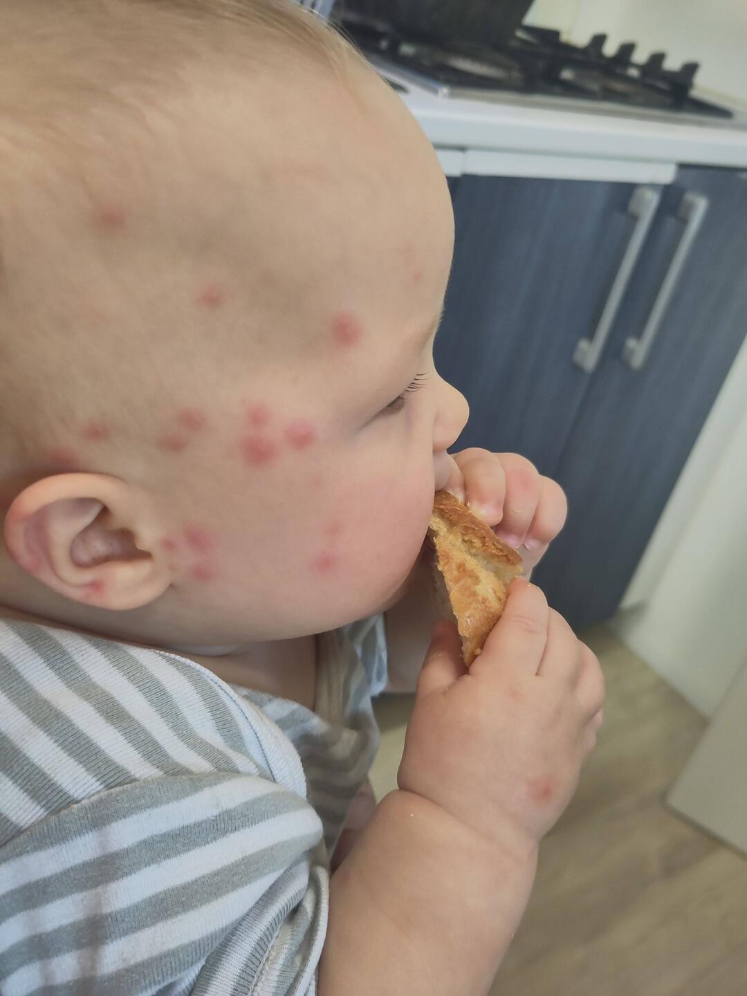 Il semblerait qu'il y avait des moustiques cette nuit...