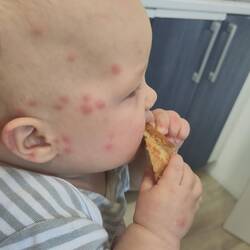 Il semblerait qu'il y avait des moustiques cette nuit...