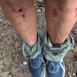 Die netten kleinen Blutegel...