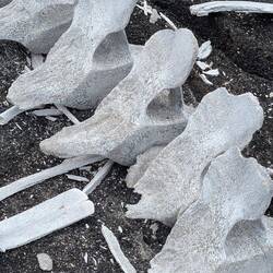 And here's one for my next talk on epidurals