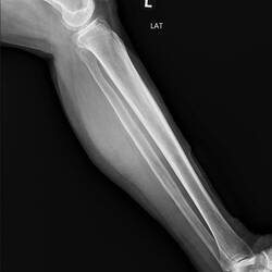 Alles sauber, hoffen auf eine schnelle Heilung ❤️‍🩹