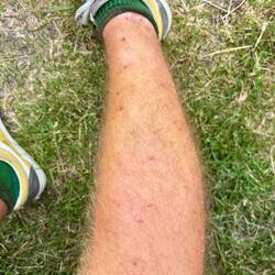 Dit is hoe m'n benen er al een tijdje uitzien