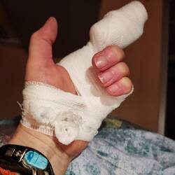 Kleinen Unfall in der Autotür