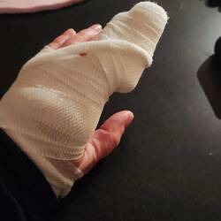 Kleiner Unfall in der Autotür