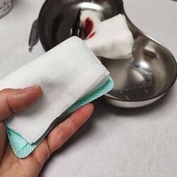 Der Verband war mit der offenen Wunde total verklebt