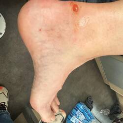 Nicis Fuss nach der Wanderung 😳