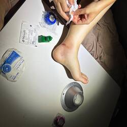 provisorischer Operationstisch gebaut