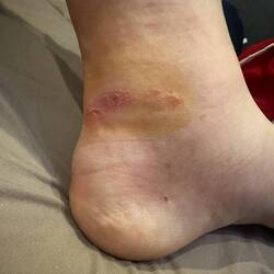 Sieht nach der ersten Nacht ganz OK aus...