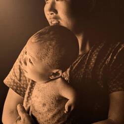 Missbildungen durch Agent Orange