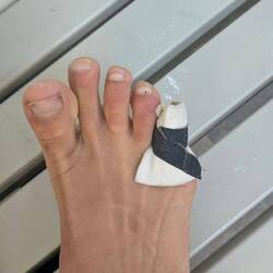 Es ist "Zeh" aber jetzt mit neuer Zehensocke