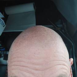 Keine schematische sondern ne scheinheilige Darstellung, alle Haare gleichlang 😉