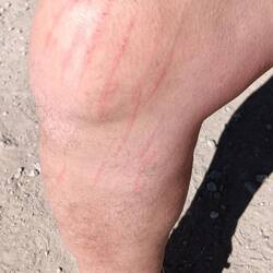 Zum Glück ist nichts Schlimmeres passiert